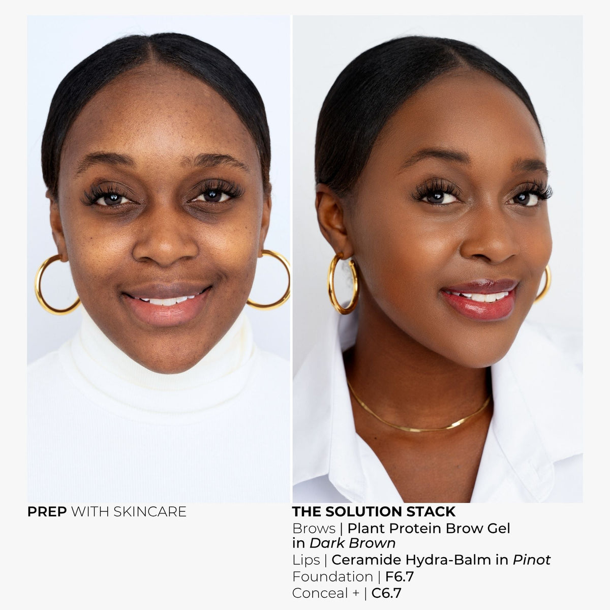 Foundation+